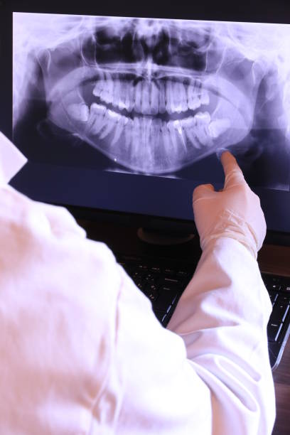 Best Emergency Dental Surgery in Roanoke, IN